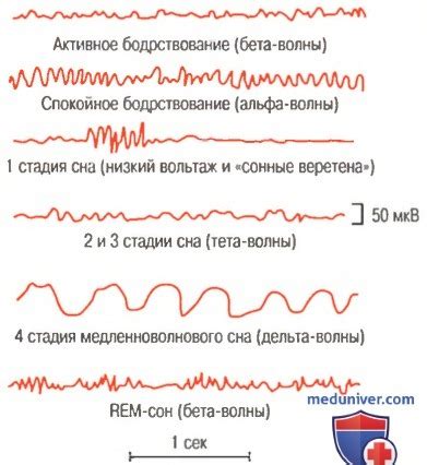 Роли различных стадий сна в работе мозга