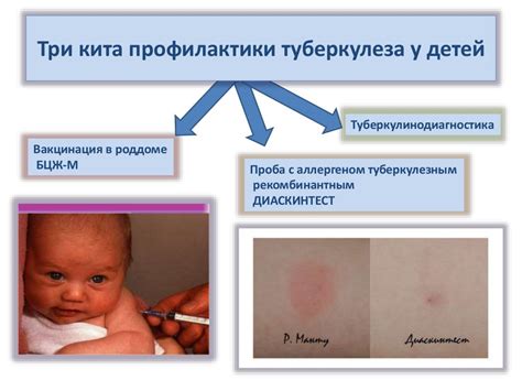 Роль Флюдитека в лечении детей