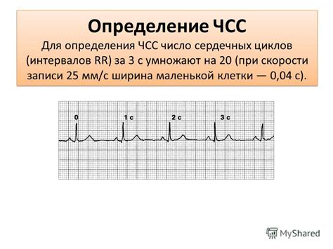 Роль ЭКГ в переднедиагностике