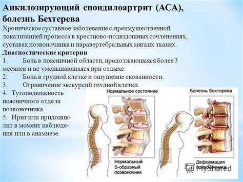 Роль паравертебральных мягких тканей в функционировании позвоночника