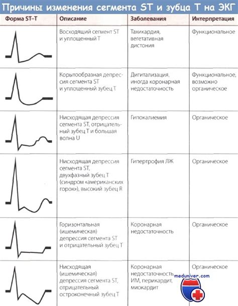 Роль электрокардиограммы в медицине