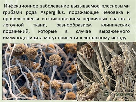 Роль IgG в борьбе с грибами рода Aspergillus