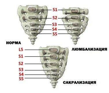 Сакрализация заключения