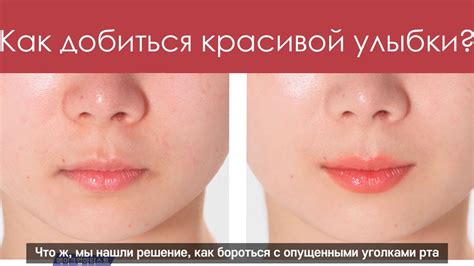 Секреты блестящей улыбки Челси