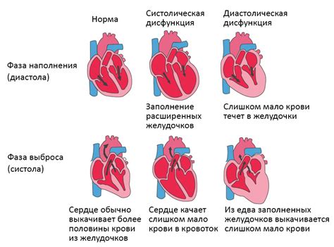 Сердечная недостаточность: что делать, когда текут ноги?