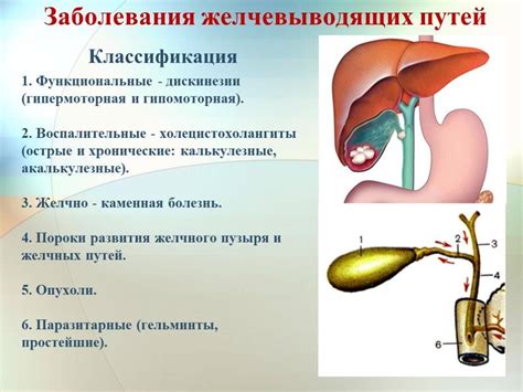 Симптомы гипоплазии желчного пузыря