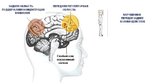 Симптомы дефицита внимания