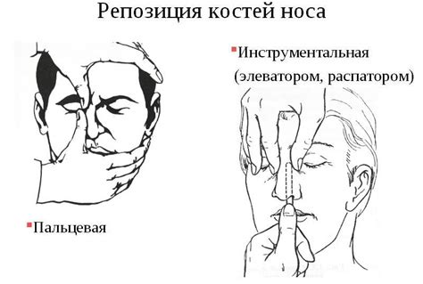 Симптомы забитого носа: как понять, что вам требуется помощь?