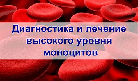 Симптомы и последствия высокого уровня моноцитов