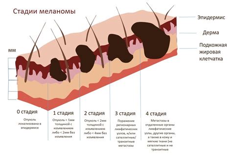 Симптомы и признаки злокачественной опухоли