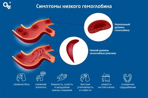 Симптомы и причины возникновения низкого уровня гемоглобина