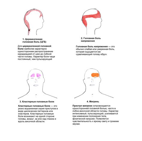 Симптомы и проявления головной боли у Понтия Пилата