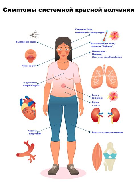 Симптомы красной волчанки у взрослых