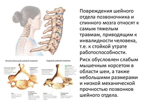 Симптомы люмбалгии шейного отдела позвоночника