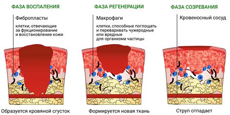 Симптомы ожога и их диагностика