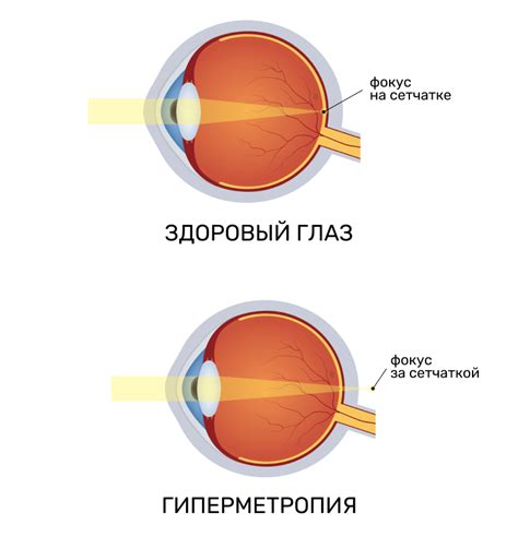 Симптомы повреждения глазных тканей