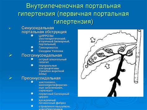 Симптомы портальной гипертензии