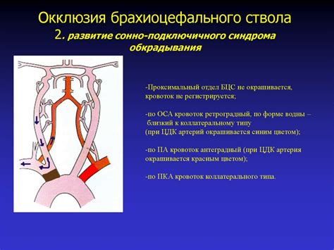 Симптомы синдрома основного ствола левой ка