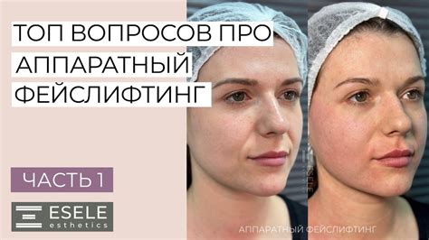 Сколько процедур нужно для достижения желаемого результата?