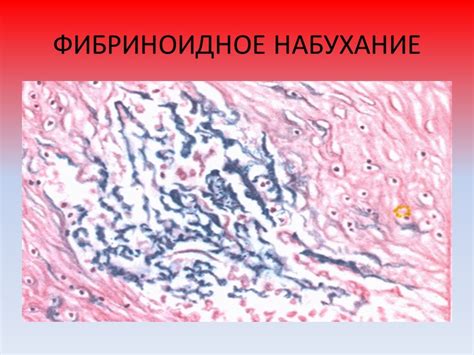 Слой поверхностных клеток в многослойном плоском неороговевающем эпителии