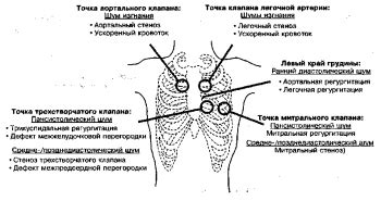 Слышимые эхо и шумы