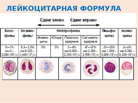 Смещение лейкоцитарной формулы