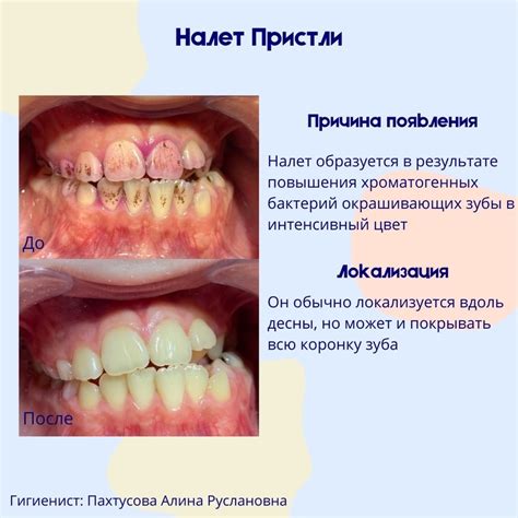 Советы о самом эффективном уходе за мезороллером