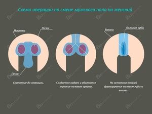 Советы по изменению пола