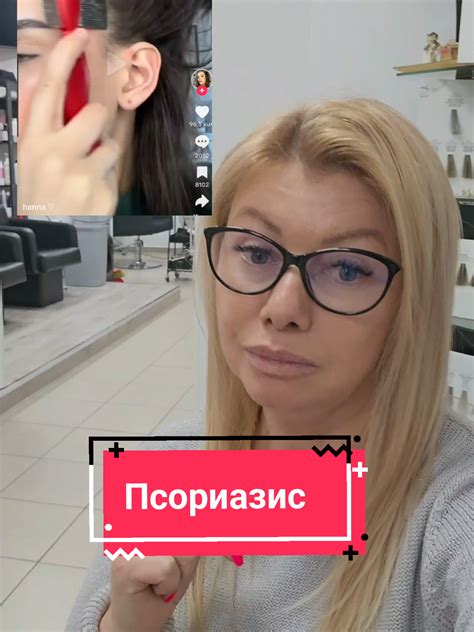 Советы по уходу за туй