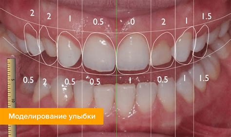 Создайте формы для зубов