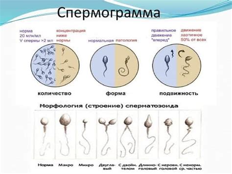 Спермограмма: методика и анализ