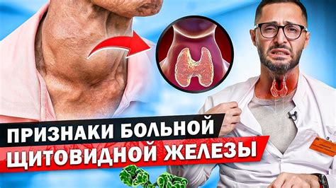 Способы профилактики увеличения щитовидной железы