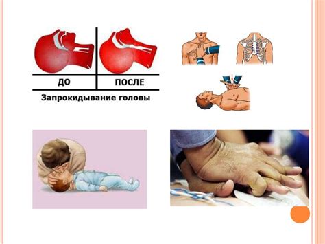 Способы реанимации раннего проростка