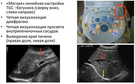 Способ 4: УЗИ печени для выявления уровня аммиака