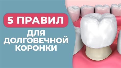 Срок службы реставрированной металлокерамической коронки