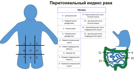 Стадии развития канцероматоза брюшины