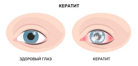 Сто глаз не зрящи, как два