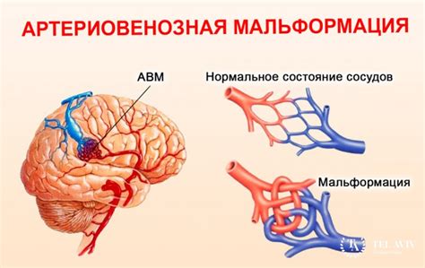 Судорожная готовность головного мозга у детей