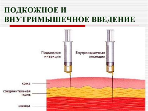 Техника инъекции интерферона