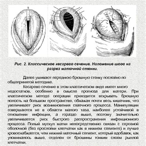 Техника операции