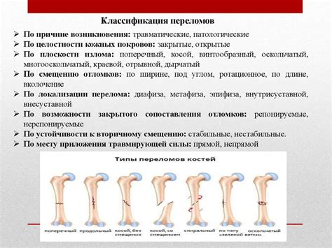 Типичные способы лечения переломов