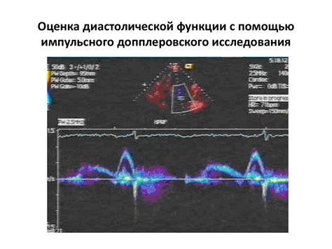 Точные результаты с помощью лазерного допплеровского вибро-реометра