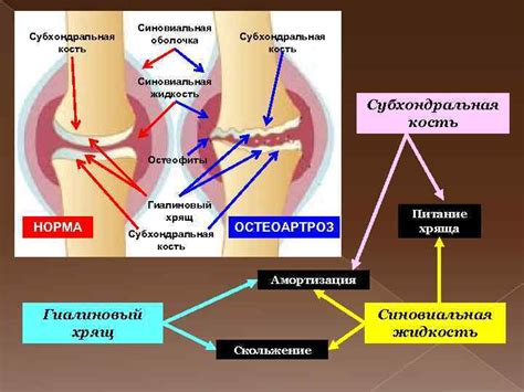 Травматические факторы, провоцирующие поражение кости