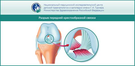 Травмы и повреждения