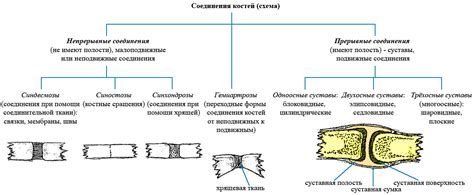 Третий шаг: соединение костей и укрепление моста