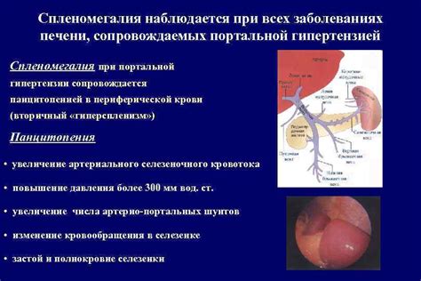 Уз причины и симптомы спленомегалии у ребенка