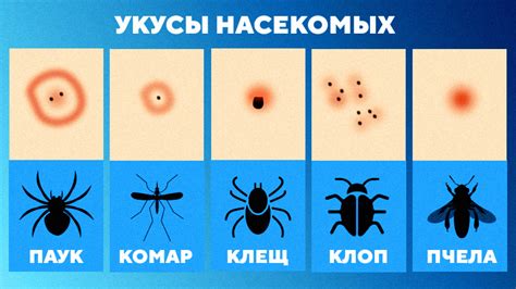 Укус насекомого или паразиты