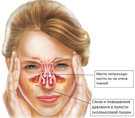 Улучшает функцию дыхания и предотвращает заложенность носа