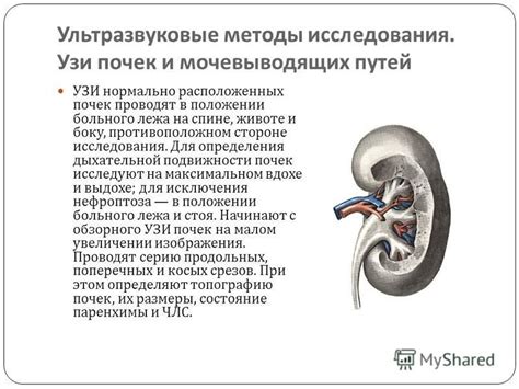 Ультразвуковые исследования для определения пола