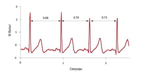 Уникальная алгоритмическая система контроля ритма сердца